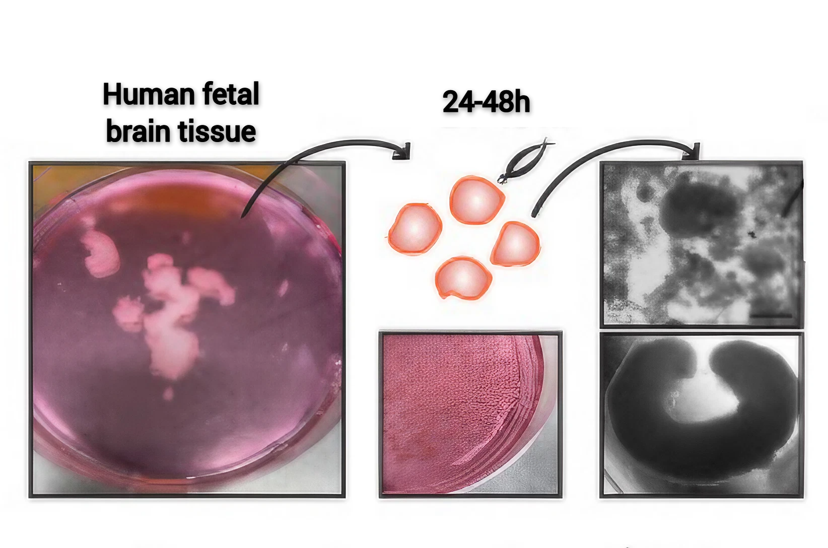 Des mini-cerveaux cultivés à partir de foetus avortés poussent en laboratoire